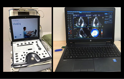撮影したエコーを解析