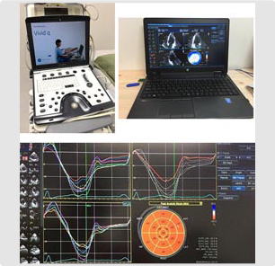 超音波検査機器1(心臓に特化)