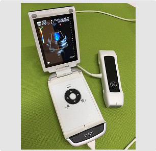 超音波検査機器3